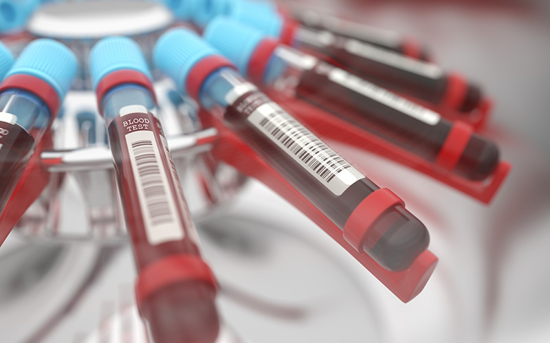 질쎄라 시술이미지